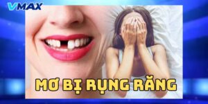 MƠ bị rụng răng